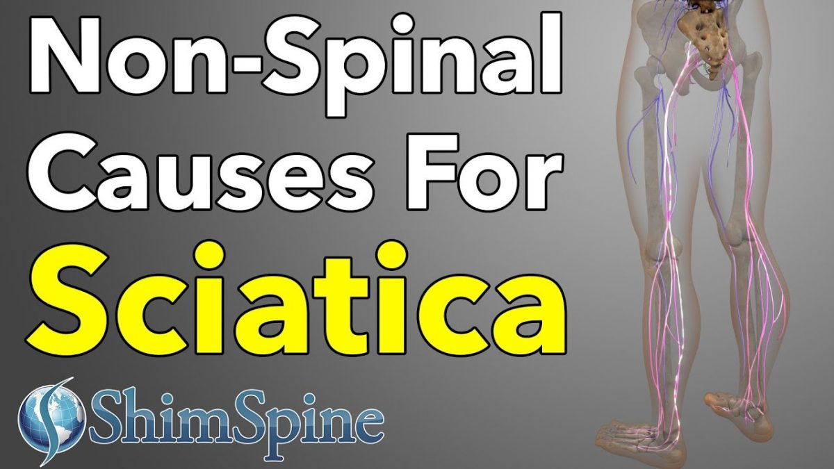 Non Spinal Causes Of Sciatica Shimspine