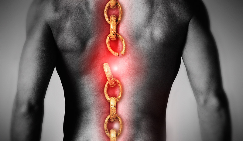 10 Causes of Back Pain