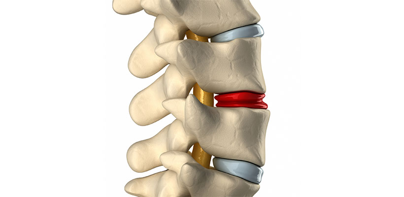 Why we have a Spine