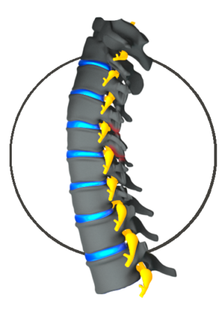 Cervical Facet Syndrome