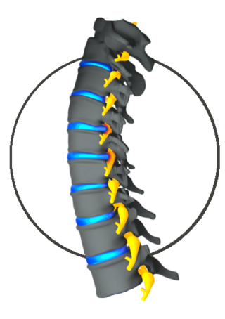 Cervical Myelopathy