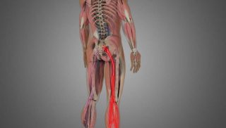 Lumbar Radiculopathy