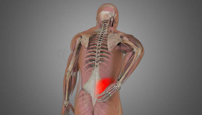 Low back Sprain-Strain - ShimSpine