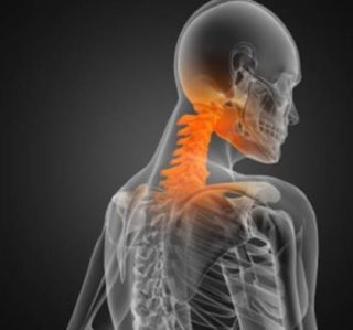 Cervical Sprain-Strain (Whiplash)