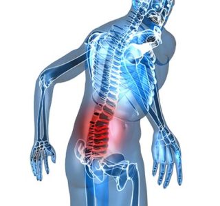Low back Sprain-Strain