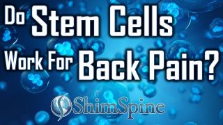 Stem cells for Back Pain