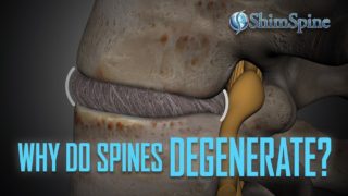 Degenerative Disc Disease