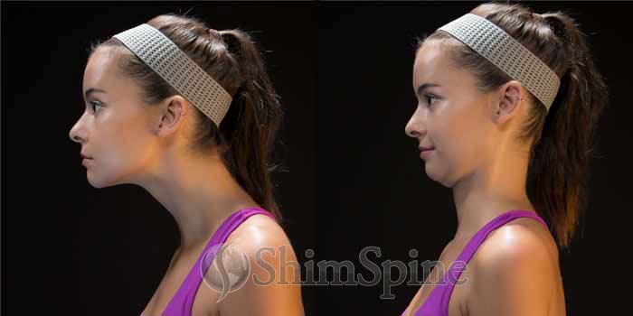 Chin Tucks