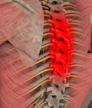 Thoracic