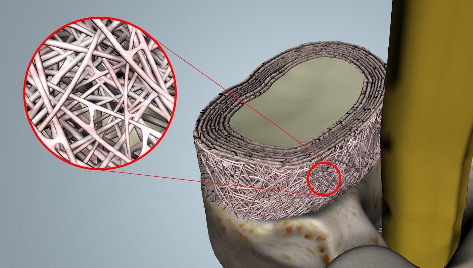 nucleus pulposus