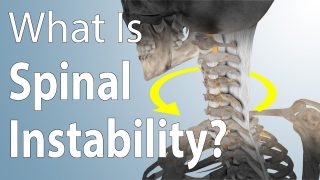 spinal instability