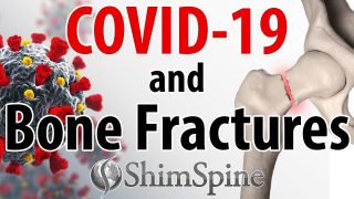 COVID-19 and Bone Fractures