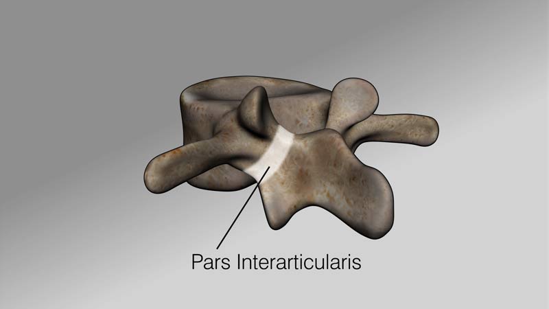 pars interarticularis