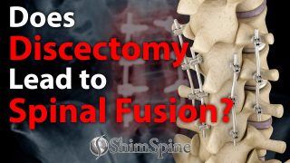 Does Discectomy Lead to Spinal Fusion?