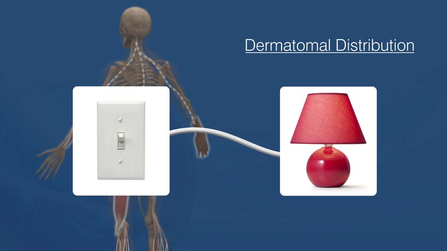 dermatomal distribution