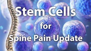 Stem Cells for Back Pain: 2020 Update