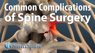 Common Complications of Spine Surgery