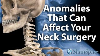 Anomalies That Can Affect Your Neck Surgery