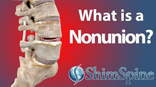 What is a Nonunion?