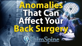 Anomalies That Can Affect Your Back Surgery