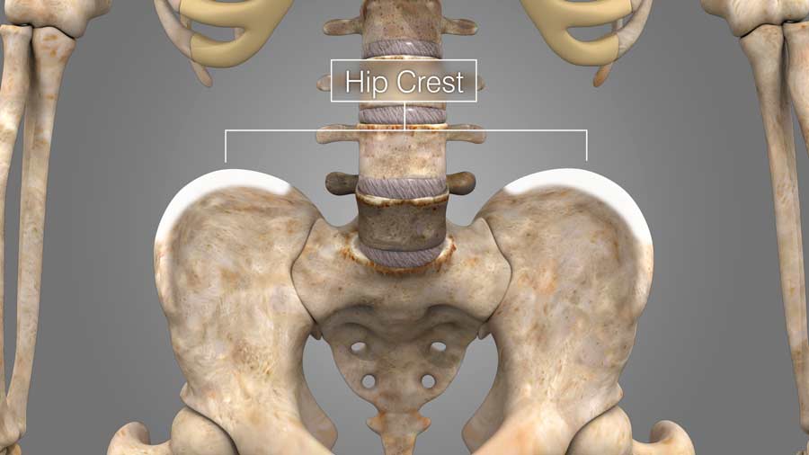 To aide in the fusion or uniting of the bones, bone tissue is obtained from your hip crest.
