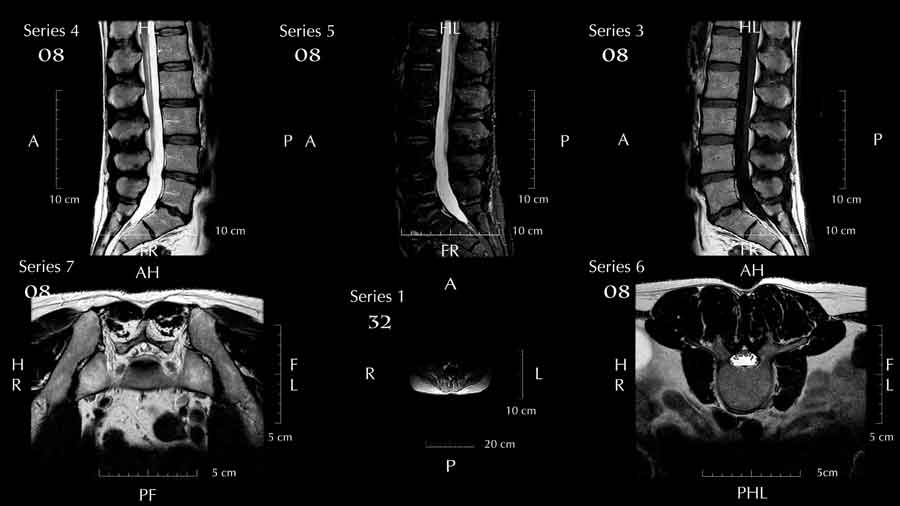 2D MRI