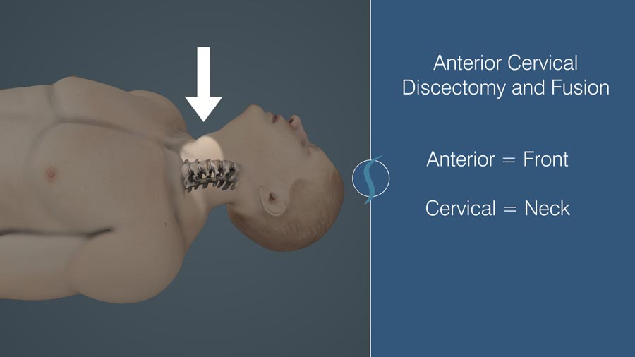 Anterior Cervical