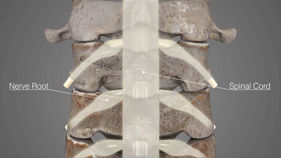Spinal Cord & Nerve Root