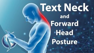 Text Neck and Forward Head Posture