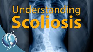 Understanding Scoliosis