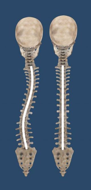 Spine Curve