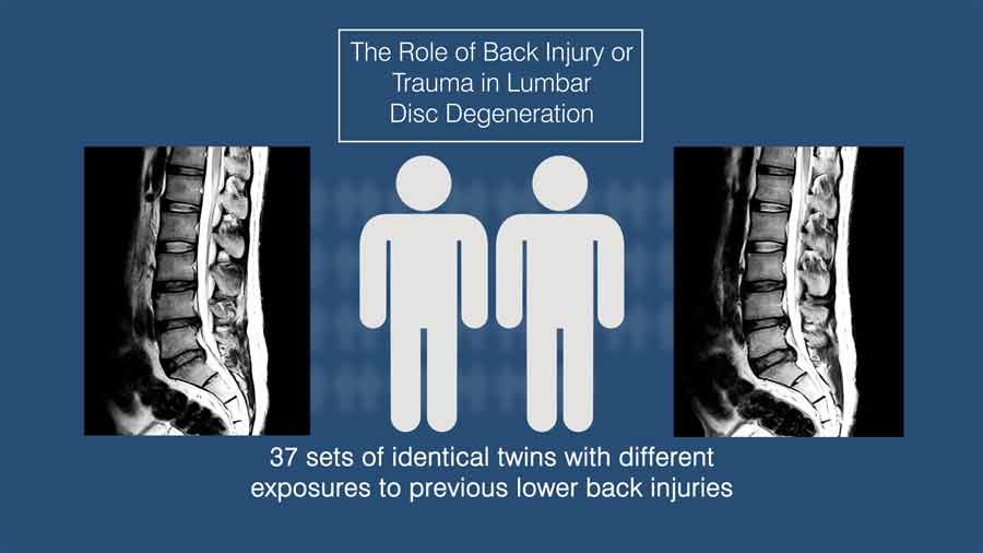 The role of back injury or trauma in lumbar disc degeneration