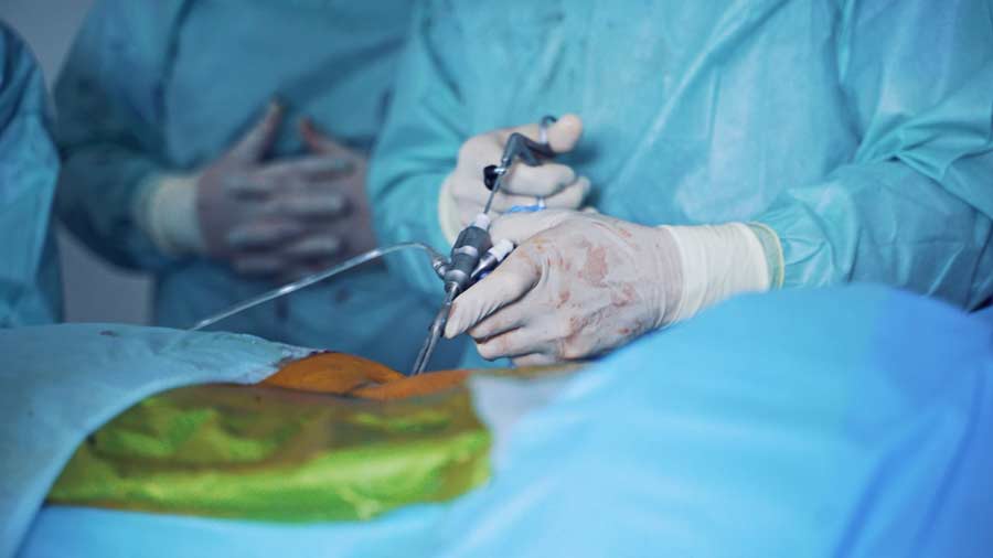 percutaneous discectomy surgery